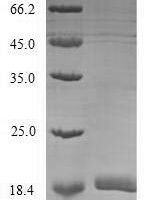 Mouse Complement receptor type 2 (Cr2), partial Recombinant Protein, N-His-Myc - BioCrest Sci