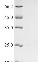 Dermatophagoides pteronyssinus Major mite allergen Der p 23 Recombinant Protein - BioCrest Sci