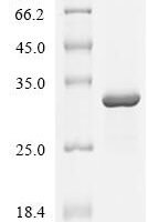 Influenza A virus RNA-directed RNA polymerase catalytic subunit (PB1), partial Recombinant Protein - BioCrest Sci