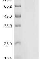 Human Protein Niban 1 (NIBAN1) Recombinant Protein - BioCrest Sci