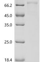 Mouse Ataxin-3 (Atxn3) Recombinant Protein, N-10His/C-hFc1 - BioCrest Sci