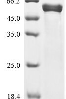 Serratia marcescens Serralysin Recombinant Protein - BioCrest Sci