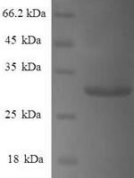 Human Gamma-synuclein (SNCG) Recombinant Protein - BioCrest Sci