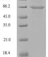 Mouse Putative phospholipase B-like 2 (Plbd2) Recombinant Protein, N-His, aa 47–594, Mammalian cell - BioCrest Sci