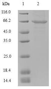 Mouse Putative phospholipase B-like 2 (Plbd2) Recombinant Protein, N-His, aa 47–594, Mammalian cell, Mus musculus (Mouse), Mammalian cell, N-terminal 6xHis-tagged, 65.9 kDa, purity >≥ 90% as determined by SDS-PAGE.