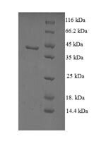 Human Non-specific lipid-transfer protein (SCP2) Recombinant Protein - BioCrest Sci
