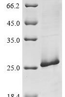 Human BRCA1-associated protein (BRAP),Partial Recombinant Protein - BioCrest Sci
