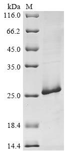 Human BRCA1-associated protein (BRAP),Partial Recombinant Protein, Homo sapiens (Human), E.coli, C-terminal 6xHis-tagged, 24.5 kDa, purity >≥ 85% as determined by SDS-PAGE.