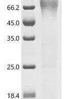 Human Pituitary homeobox 1 (PITX1) Recombinant Protein - BioCrest Sci
