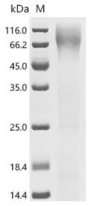 Human Pituitary homeobox 1 (PITX1) Recombinant Protein, Homo sapiens (Human), Yeast, C-terminal 6xHis-tagged, 35.4 kDa, purity >Greater than 85% as determined by SDS-PAGE.