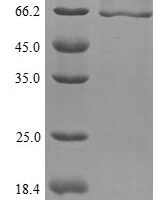 Mouse Lysosomal acid Glucosylceramidase (Gba1) Recombinant Protein, N-His - BioCrest Sci