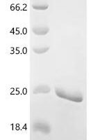 Nodamura virus Protein B2 (B2) Recombinant Protein - BioCrest Sci