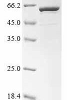 Human N(6)-adenine-specific methyltransferase METTL4 (METTL4) Recombinant Protein - BioCrest Sci