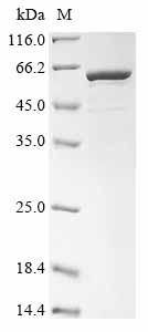 Human N(6)-adenine-specific methyltransferase METTL4 (METTL4) Recombinant Protein, Homo sapiens (Human), E.coli, N-terminal 10xHis-tagged and C-terminal Myc-tagged, 61.5 kDa, purity >≥ 85% as determined by SDS-PAGE.