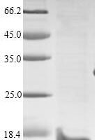 Human Prolactin-inducible protein (PIP) Recombinant Protein, N-10His - BioCrest Sci