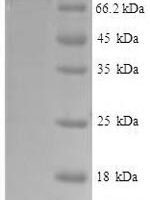Human Vascular cell adhesion protein 1 (VCAM1), partial Recombinant Protein, N-His-SUMO - BioCrest Sci