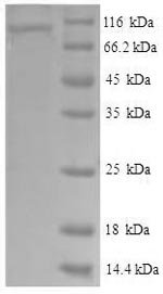 Human Vascular cell adhesion protein 1 (VCAM1), partial Recombinant Protein, N-His-SUMO, Homo sapiens (Human), E.coli, N-terminal 6xHis-SUMO-tagged, 90.2 kDa, purity >≥ 90% as determined by SDS-PAGE.