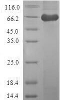 Human Macrophage-capping protein (CAPG) Recombinant Protein - BioCrest Sci