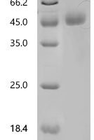 Human Neuronal acetylcholine receptor subunit alpha-9 (CHRNA9), partial Recombinant Protein, N-His-SUMOstar-Avi - BioCrest Sci