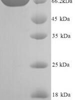 Human Vascular cell adhesion protein 1 (VCAM1), partial Recombinant Protein, N-His - BioCrest Sci