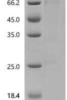 Mouse Transcription factor SOX-2 (Sox2) Recombinant Protein - BioCrest Sci