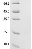 Human Kidney-associated antigen 1(KAAG1) Recombinant Protein - BioCrest Sci