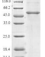 Human UPF0568 protein C14orf166 (C14orf166) Recombinant Protein - BioCrest Sci