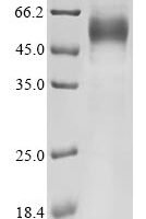 Human Interleukin-13 (IL13) Recombinant Protein, C-hFc1 - BioCrest Sci