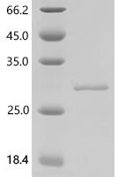 Human Integrin alpha-2 (ITGA2),partial Recombinant Protein - BioCrest Sci