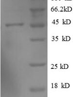 Human ADP-ribosylation factor-like protein 2-binding protein (ARL2BP) Recombinant Protein - BioCrest Sci
