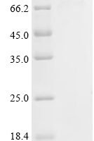 Rat Ubiquitin carboxyl-terminal hydrolase 19 (Usp19), partial Recombinant Protein - BioCrest Sci
