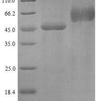 Human Plasminogen activator inhibitor 2 (SERPINB2) Recombinant Protein - BioCrest Sci