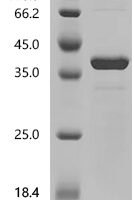 Human EF-hand domain-containing protein D2 (EFHD2) Recombinant Protein - BioCrest Sci