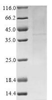 Vaccinia virus Protein K3 (VACWR034) Recombinant Protein - BioCrest Sci
