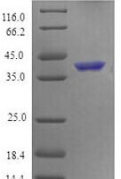 Mouse Tumor necrosis factor receptor superfamily member 4 (Tnfrsf4), partial Recombinant Protein - BioCrest Sci
