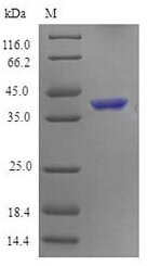 Mouse Tumor necrosis factor receptor superfamily member 4 (Tnfrsf4), partial Recombinant Protein, Mus musculus (Mouse), E.coli, N-terminal 6xHis-SUMO-tagged, 37.3 kDa, purity >≥ 90% as determined by SDS-PAGE.