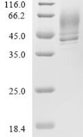 Staphylococcus aureus Alpha-hemolysin (hly) Recombinant Protein, N-His - BioCrest Sci