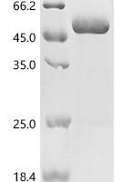 Rat RNA-binding protein Nova-1 (Nova1) Recombinant Protein, C-His, aa 1–474, Rattus norvegicus (Rat) - BioCrest Sci
