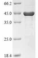 Vaccinia virus 3 beta-hydroxysteroid dehydrogenase/Delta 5——》4-isomerase (VACWR170) Recombinant Protein - BioCrest Sci