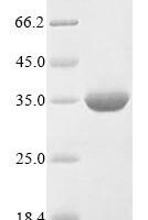 Triticum aestivum Granule-bound starch synthase 1,chloroplastic/amyloplastic (WAXY), partial Recombinant Protein - BioCrest Sci