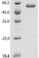 Human IL27B&IL27A Heterodimer Protein Recombinant Protein - BioCrest Sci