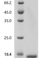 Escherichia coli O157:H7 Hydrogenase 3 maturation protease (hycI) Recombinant Protein, C-His - BioCrest Sci