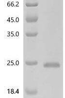 Human C-X-C motif chemokine 9 (Cxcl9) Recombinant Protein, C-His - BioCrest Sci