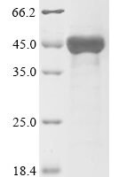 Human TAR DNA-binding protein 43 (TARDBP) Recombinant Protein - BioCrest Sci