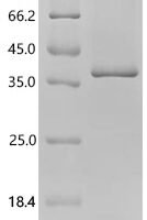 Strongyloides stercoralis L3NieAg.01 (L3Nie.01) (X208Y,X221W), partial Recombinant Protein - BioCrest Sci