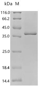 Strongyloides stercoralis L3NieAg.01 (L3Nie.01) (X208Y,X221W), partial Recombinant Protein, Strongyloides stercoralis (Threadworm), E.coli, C-terminal 6xHis-tagged, 33.3 kDa, purity >≥ 90% as determined by SDS-PAGE.