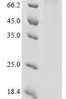 Human Epidermal growth factor receptor (EGFR), partial Recombinant Protein, C-His-SpyTag003 - BioCrest Sci