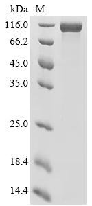 Human Epidermal growth factor receptor (EGFR), partial Recombinant Protein, C-His-SpyTag003, Homo sapiens (Human), Mammalian cell, C-terminal 6xHis-SpyTag003-tagged, 72.8 kDa, purity >≥ 95% as determined by SDS-PAGE.≥ 90% as determined by SEC-HPLC.