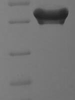 Human MOB kinase activator 1A (MOB1A) Recombinant Protein - BioCrest Sci