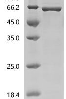 Human Steroid 17-alpha-hydroxylase/17,20 lyase (CYP17A1) Recombinant Protein, C-His - BioCrest Sci